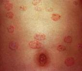 ��Ѣ�ļ����ص�