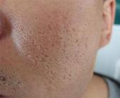 �Σ�����֮�̺�