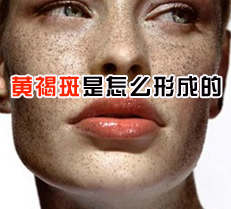 �ƺְ�����ô�γɵ�