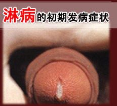 �ܲ��ĳ��ڷ���֢״