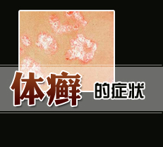 ��Ѣ��֢״ͼ