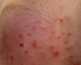 ������Ƥ��