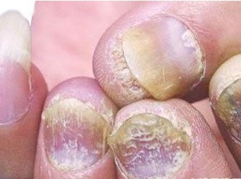 �ϲ����ƻ�ָ����õ�ҽԺ