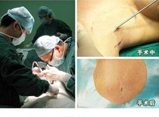 ����΢������