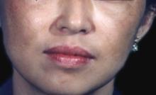 �����Ҳ��һ�ֻƺְ�