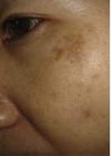 �ƺְ߸���ôȥ��