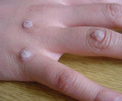 �ֲ�Ѱ����