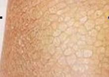 ���״���۲�