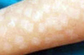 ������ôԤ������