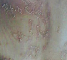 ���ţƤѢ��������ʲô