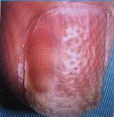 �ֽ�ţƤѢ�ķ����ص�