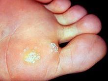 ����Ѱ���ࡪ������