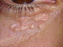 ��ҽ��Ϊ��ƽ����γ�