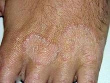 ����Ѣ����Щ����֢״