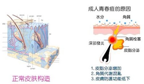 ��������ͼ