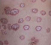 ��Ѣ���ٴ������ص�