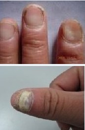 �����ָ�����״��