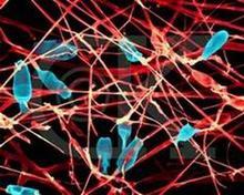 ��ָ�ף���Ѣ���ɺζ���