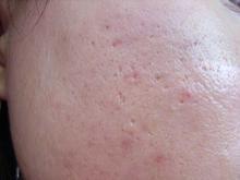 �ഺ�������ȷԤ��Ҫ��