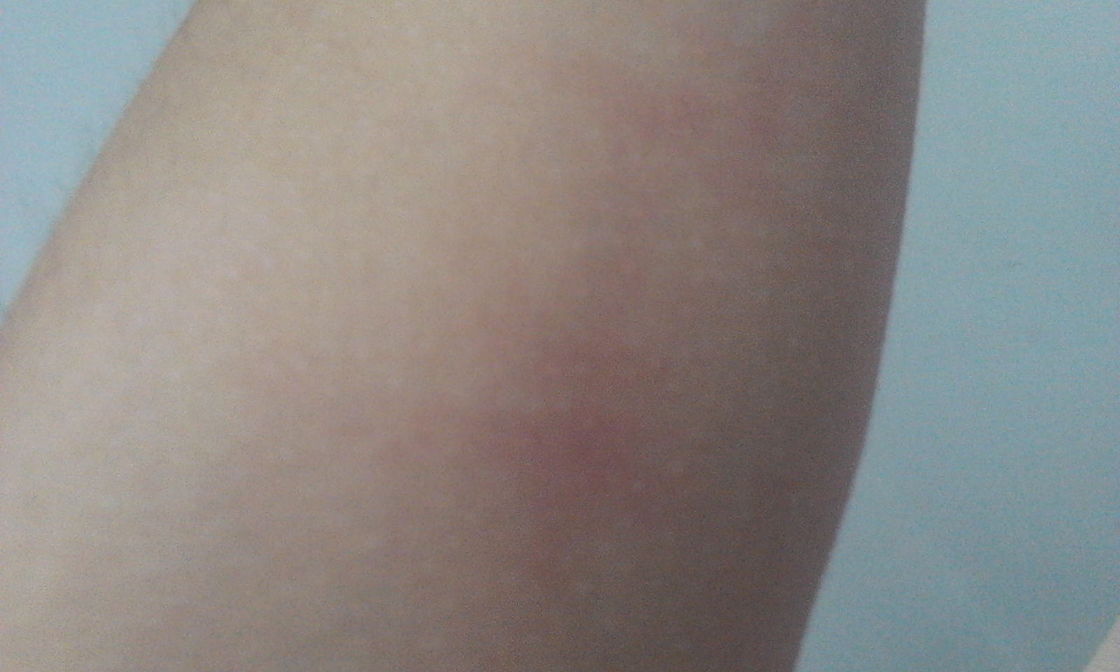 Ƥ��������Σ����ʲô