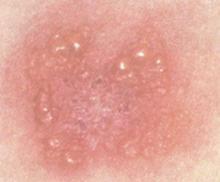 ��ƽ���֢״��������Щ