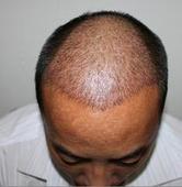 ����֬�����ѷ�ͼƬ