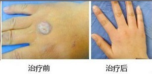 Ѱ���������ͼƬ