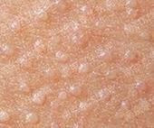 ������ƽ��֢״����