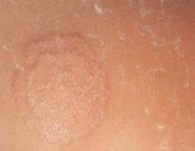 ��Ѣ֢״����