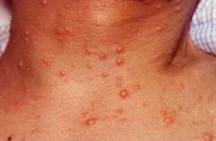 ��״����ͼƬ