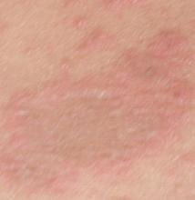 ����ʪ��֢״����