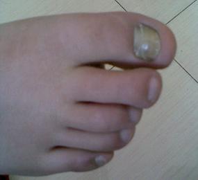 ��΢��ָ��ͼƬ