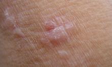 �ֲ���ƽ��ͼƬ