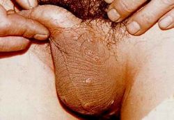 �������ҽ괯ͼƬ