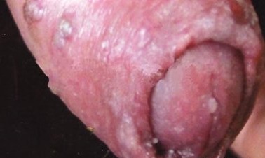 ���Լ���ʪ�����ͼƬ