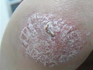 ����ţƤѢͼƬ