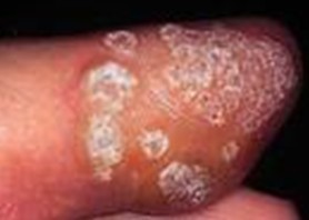 Ѱ���������ƫ��