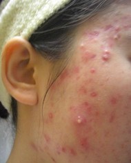 �ഺ����ͼƬ