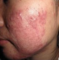 �ഺ���Ĳ�����Ҫ������������ϵ����