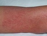 ����ݡ������볱ʪ�й�ϵ��