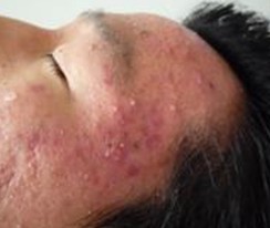 ϸ�����ű��γ����ഺ��