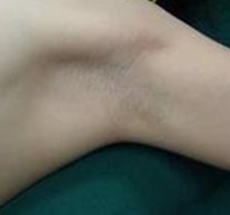 �ϲ���ɽƤ����ҽԺ����Ҹ��