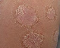 ţƤѢ����Ҫע���������