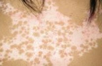 ������ɢʱ�ı���֢״������Щ��