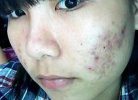 �����ഺ������Ҫȥ�����أ�