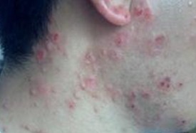 �ഺ���ı�����̬