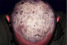 Ѱ����ţƤѢ��������