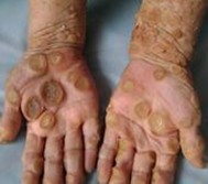 Ѱ�����֢״����