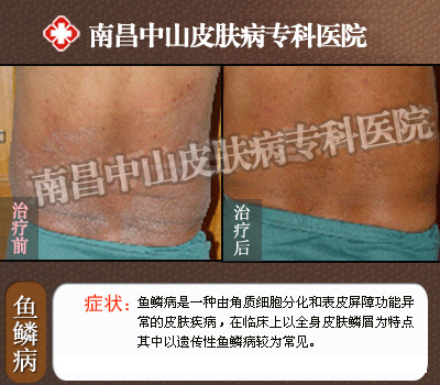 ���۲����ݺ��ӵ��Ŵ�����