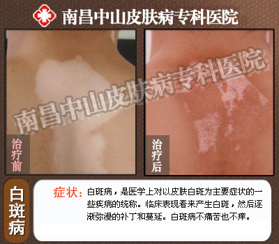 ��������ĳ�������